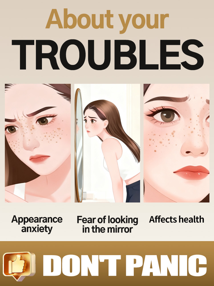 Lightening Facial Freckles Mel - Ultra Luxury Skincare review and price