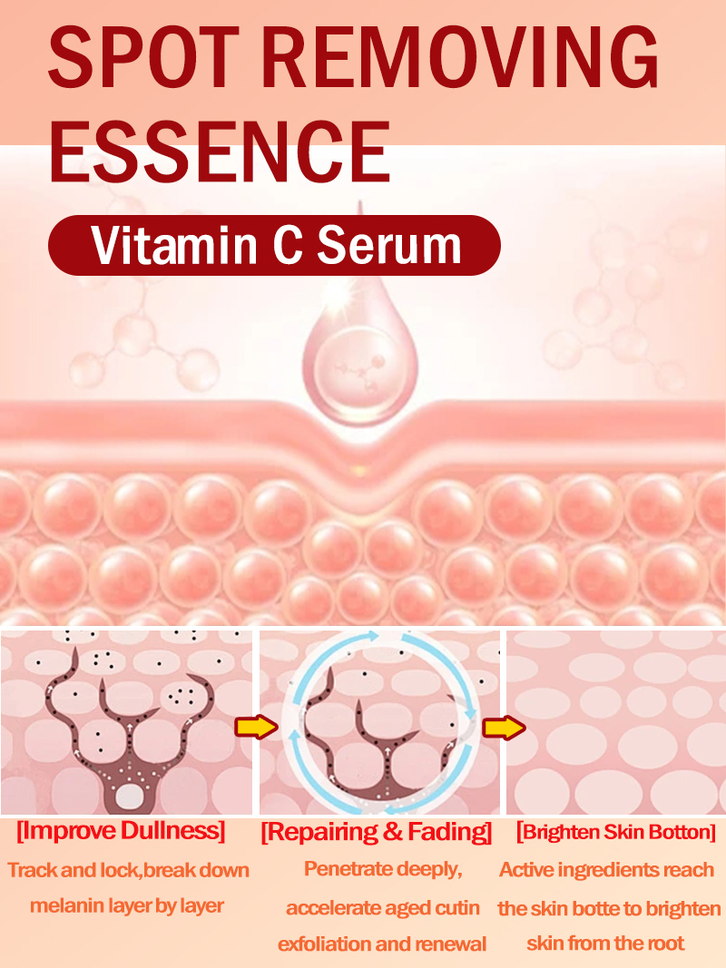 Lighten Freckles Melasma, Faci - Ultra Luxury Skincare review and price